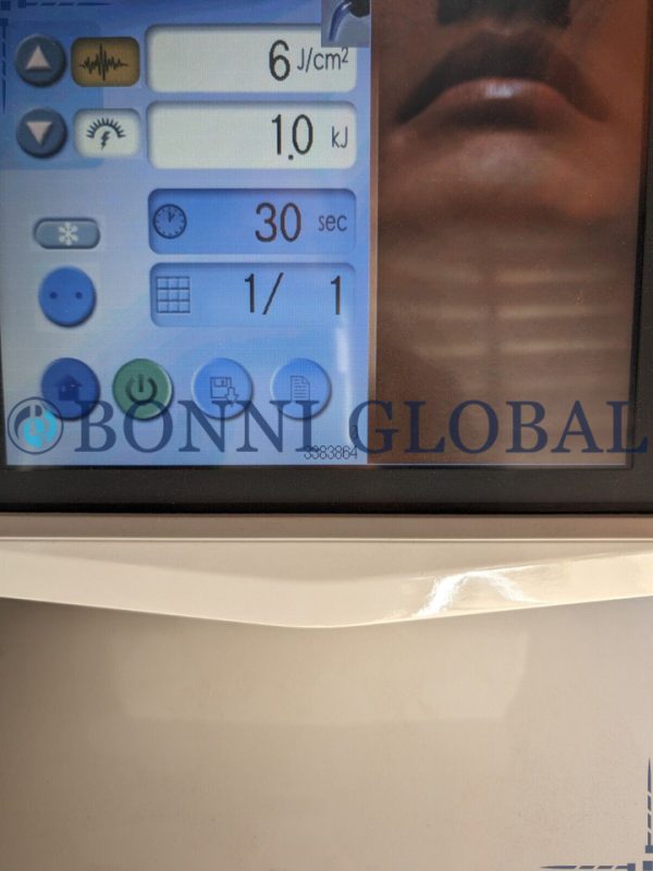 Alma Soprano Lite Hair Removal Laser - Image 6